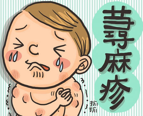 儿童过敏性荨麻疹都有哪些原因呢?