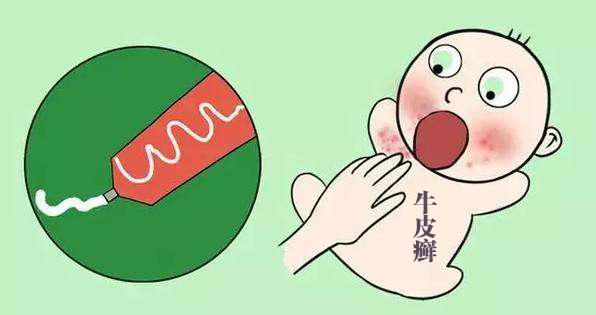 儿童银屑病和遗传关系大不大呢?